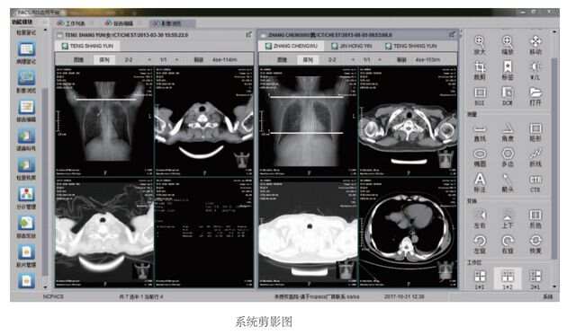 医院ibms智能化集成系统品牌_ibms系统叫什么_智能医院看护系统